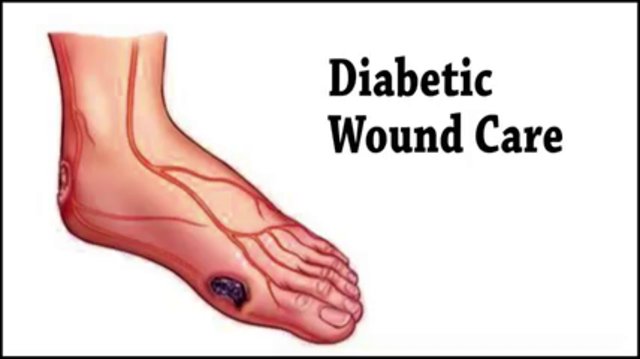 DIABETIC WOUND CARE